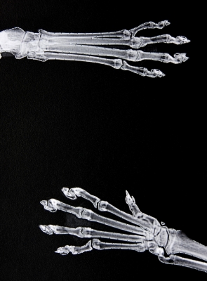 Poten detail